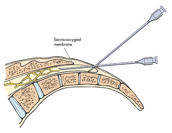 三亿体育手机版